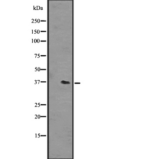 OR51L1 Antibody - Western blot analysis of OR51L1 expression in NCI-H292 cells line lysates. The lane on the left is treated with the antigen-specific peptide.