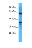 OR51M1 Antibody - Western blot of Human Jurkat. OR51M1 antibody dilution 1.0 ug/ml.  This image was taken for the unconjugated form of this product. Other forms have not been tested.