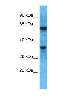OR51M1 Antibody - Western blot of Human Jurkat. OR51M1 antibody dilution 1.0 ug/ml.  This image was taken for the unconjugated form of this product. Other forms have not been tested.