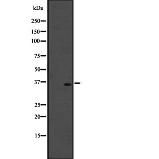 OR51M1 Antibody - Western blot analysis of OR51M1 expression in SiHa cells line lysates. The lane on the left is treated with the antigen-specific peptide.