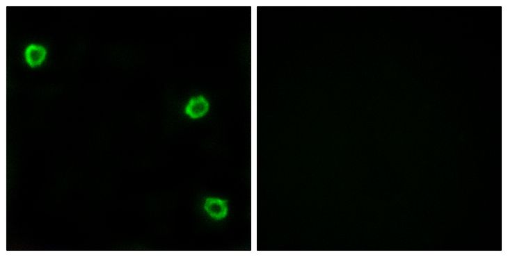 OR51Q1 Antibody - Immunofluorescence analysis of LOVO cells, using OR51Q1 Antibody. The picture on the right is blocked with the synthesized peptide.