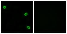 OR51Q1 Antibody - Immunofluorescence analysis of LOVO cells, using OR51Q1 Antibody. The picture on the right is blocked with the synthesized peptide.