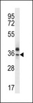 OR51Q1 Antibody - OR51Q1 Antibody western blot of MDA-MB435 cell line lysates (35 ug/lane). The OR51Q1 antibody detected the OR51Q1 protein (arrow).
