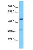 OR51S1 Antibody - OR51S1 antibody Western Blot of Jurkat. Antibody dilution: 1 ug/ml.  This image was taken for the unconjugated form of this product. Other forms have not been tested.