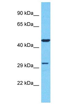 OR51S1 Antibody - OR51S1 antibody Western Blot of Jurkat. Antibody dilution: 1 ug/ml.  This image was taken for the unconjugated form of this product. Other forms have not been tested.