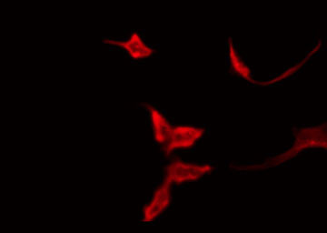 OR51T1 Antibody - Staining HT29 cells by IF/ICC. The samples were fixed with PFA and permeabilized in 0.1% Triton X-100, then blocked in 10% serum for 45 min at 25°C. The primary antibody was diluted at 1:200 and incubated with the sample for 1 hour at 37°C. An Alexa Fluor 594 conjugated goat anti-rabbit IgG (H+L) Ab, diluted at 1/600, was used as the secondary antibody.
