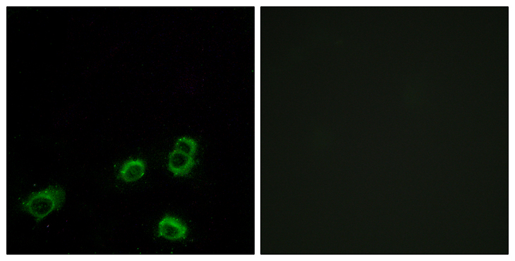 OR52A1 Antibody - Immunofluorescence analysis of MCF7 cells, using OR52A1 Antibody. The picture on the right is blocked with the synthesized peptide.
