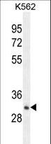 OR52A1 Antibody - OR52A1 Antibody western blot of K562 cell line lysates (35 ug/lane). The OR52A1 antibody detected the OR52A1 protein (arrow).