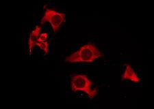 OR52A1 Antibody - Staining HeLa cells by IF/ICC. The samples were fixed with PFA and permeabilized in 0.1% Triton X-100, then blocked in 10% serum for 45 min at 25°C. The primary antibody was diluted at 1:200 and incubated with the sample for 1 hour at 37°C. An Alexa Fluor 594 conjugated goat anti-rabbit IgG (H+L) Ab, diluted at 1/600, was used as the secondary antibody.