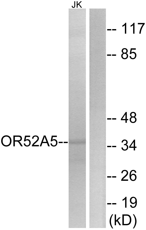 OR52A5 Antibody - Western blot analysis of lysates from Jurkat cells, using OR52A5 Antibody. The lane on the right is blocked with the synthesized peptide.