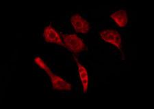OR52A5 Antibody - Staining HeLa cells by IF/ICC. The samples were fixed with PFA and permeabilized in 0.1% Triton X-100, then blocked in 10% serum for 45 min at 25°C. The primary antibody was diluted at 1:200 and incubated with the sample for 1 hour at 37°C. An Alexa Fluor 594 conjugated goat anti-rabbit IgG (H+L) Ab, diluted at 1/600, was used as the secondary antibody.