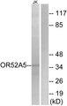 OR52A5 Antibody - Western blot analysis of extracts from Jurkat cells, using OR52A5 antibody.