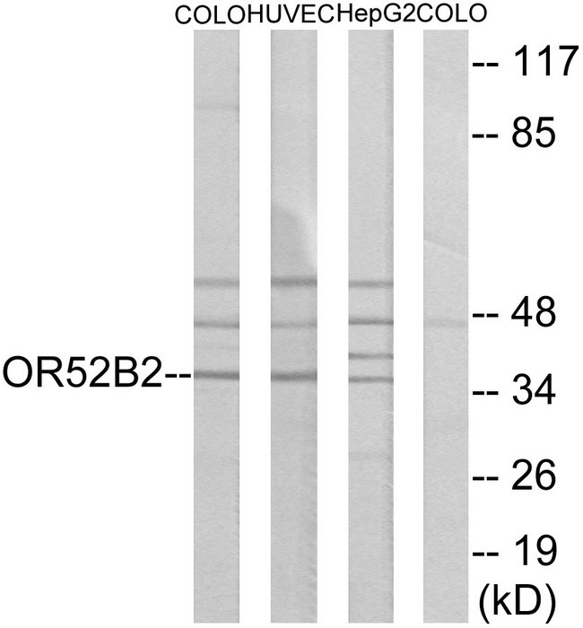 OR52B2 Antibody - Western blot analysis of lysates from COLO, HUVEC, and HepG2 cells, using OR52B2 Antibody. The lane on the right is blocked with the synthesized peptide.