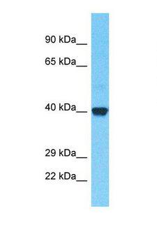 OR52B2 Antibody - Western blot of Human Fetal Kidney. OR52B2 antibody dilution 1.0 ug/ml.  This image was taken for the unconjugated form of this product. Other forms have not been tested.