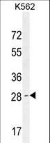 OR52D1 Antibody - OR52D1 Antibody western blot of K562 cell line lysates (35 ug/lane). The OR52D1 antibody detected the OR52D1 protein (arrow).