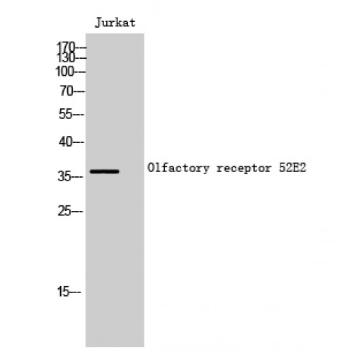 OR52E2 Antibody - Western blot of Olfactory receptor 52E2 antibody