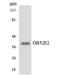 OR52E2 Antibody - Western blot analysis of the lysates from HeLa cells using OR52E2 antibody.