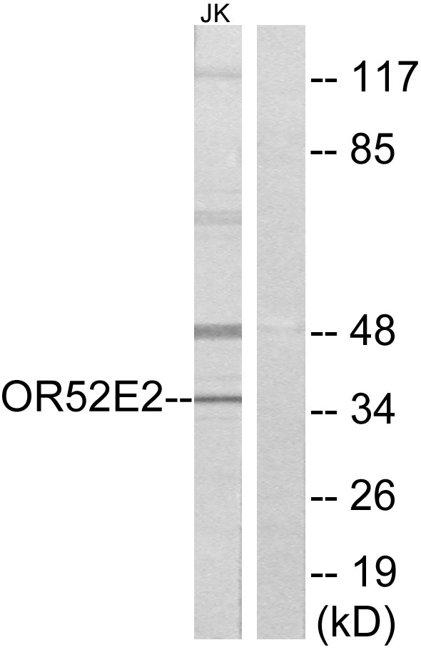 OR52E2 Antibody - Western blot analysis of lysates from Jurkat cells, using OR52E2 Antibody. The lane on the right is blocked with the synthesized peptide.
