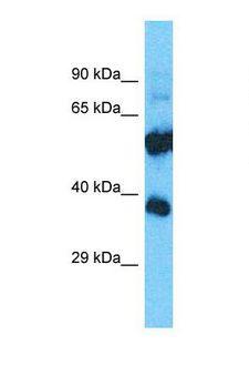 OR52E2 Antibody - Western blot of Human Placenta. OR52E2 antibody dilution 1.0 ug/ml.  This image was taken for the unconjugated form of this product. Other forms have not been tested.
