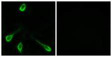 OR52E4 Antibody - Immunofluorescence analysis of LOVO cells, using OR52E4 Antibody. The picture on the right is blocked with the synthesized peptide.