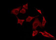 OR52E4 Antibody - Staining HepG2 cells by IF/ICC. The samples were fixed with PFA and permeabilized in 0.1% Triton X-100, then blocked in 10% serum for 45 min at 25°C. The primary antibody was diluted at 1:200 and incubated with the sample for 1 hour at 37°C. An Alexa Fluor 594 conjugated goat anti-rabbit IgG (H+L) Ab, diluted at 1/600, was used as the secondary antibody.