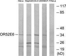 OR52E6 Antibody - Western blot analysis of lysates from HeLa, HepG2, COLO, and MCF-7 cells, using OR52E6 Antibody. The lane on the right is blocked with the synthesized peptide.