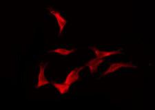 OR52E6 Antibody - Staining HeLa cells by IF/ICC. The samples were fixed with PFA and permeabilized in 0.1% Triton X-100, then blocked in 10% serum for 45 min at 25°C. The primary antibody was diluted at 1:200 and incubated with the sample for 1 hour at 37°C. An Alexa Fluor 594 conjugated goat anti-rabbit IgG (H+L) Ab, diluted at 1/600, was used as the secondary antibody.