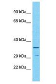 OR52I2 Antibody - OR52I2 antibody Western Blot of HT1080. Antibody dilution: 1 ug/ml.  This image was taken for the unconjugated form of this product. Other forms have not been tested.