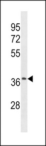 OR52J3 Antibody - OR52J3 Antibody western blot of A2058 cell line lysates (35 ug/lane). The OR52J3 antibody detected the OR52J3 protein (arrow).