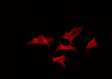 OR52K1 Antibody - Staining 293 cells by IF/ICC. The samples were fixed with PFA and permeabilized in 0.1% Triton X-100, then blocked in 10% serum for 45 min at 25°C. The primary antibody was diluted at 1:200 and incubated with the sample for 1 hour at 37°C. An Alexa Fluor 594 conjugated goat anti-rabbit IgG (H+L) Ab, diluted at 1/600, was used as the secondary antibody.