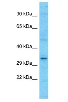 OR52N1 Antibody - OR52N1 antibody Western Blot of HCT15. Antibody dilution: 1 ug/ml.  This image was taken for the unconjugated form of this product. Other forms have not been tested.