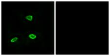 OR52N1 Antibody - Immunofluorescence analysis of LOVO cells, using OR52N1 Antibody. The picture on the right is blocked with the synthesized peptide.