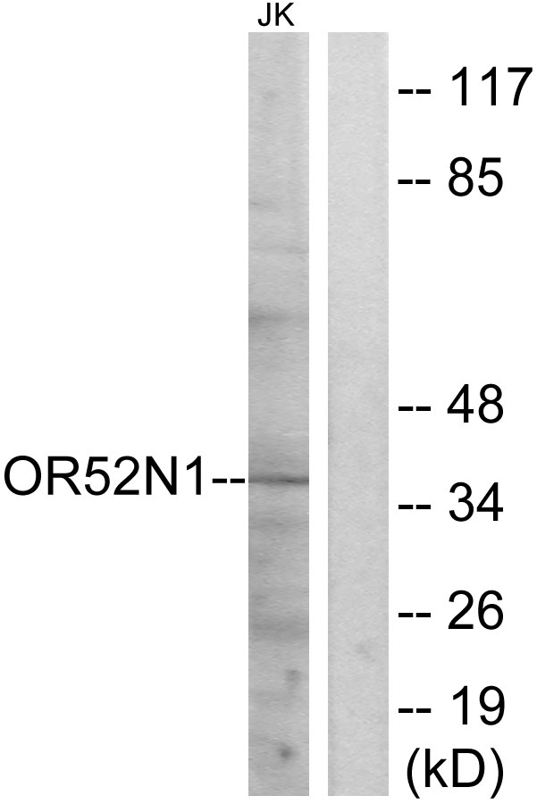 OR52N1 Antibody - Western blot analysis of lysates from Jurkat cells, using OR52N1 Antibody. The lane on the right is blocked with the synthesized peptide.