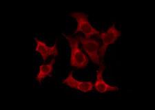 OR52N1 Antibody - Staining HeLa cells by IF/ICC. The samples were fixed with PFA and permeabilized in 0.1% Triton X-100, then blocked in 10% serum for 45 min at 25°C. The primary antibody was diluted at 1:200 and incubated with the sample for 1 hour at 37°C. An Alexa Fluor 594 conjugated goat anti-rabbit IgG (H+L) Ab, diluted at 1/600, was used as the secondary antibody.