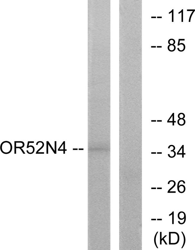 OR52N4 Antibody - Western blot analysis of lysates from HeLa cells, using OR52N4 Antibody. The lane on the right is blocked with the synthesized peptide.