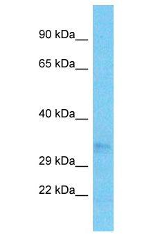 OR52N5 Antibody - OR52N5 antibody Western Blot of ACHN. Antibody dilution: 1 ug/ml.  This image was taken for the unconjugated form of this product. Other forms have not been tested.