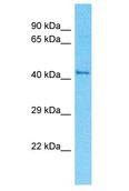 OR52R1 Antibody - OR52R1 antibody Western Blot of HT1080. Antibody dilution: 1 ug/ml.  This image was taken for the unconjugated form of this product. Other forms have not been tested.