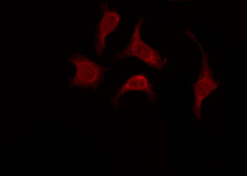 OR52W1 Antibody - Staining HeLa cells by IF/ICC. The samples were fixed with PFA and permeabilized in 0.1% Triton X-100, then blocked in 10% serum for 45 min at 25°C. The primary antibody was diluted at 1:200 and incubated with the sample for 1 hour at 37°C. An Alexa Fluor 594 conjugated goat anti-rabbit IgG (H+L) Ab, diluted at 1/600, was used as the secondary antibody.