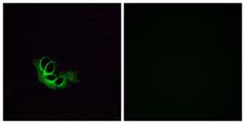 OR56A1 Antibody - Immunofluorescence analysis of HeLa cells, using OR56A1 Antibody. The picture on the right is blocked with the synthesized peptide.