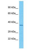 OR56A3 Antibody - OR56A3 antibody Western Blot of RPMI-8226. Antibody dilution: 1 ug/ml.  This image was taken for the unconjugated form of this product. Other forms have not been tested.