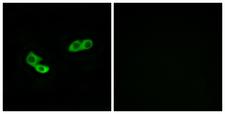 OR56A3 Antibody - Immunofluorescence analysis of LOVO cells, using OR56A3 Antibody. The picture on the right is blocked with the synthesized peptide.