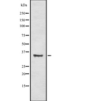 OR56A4 Antibody - Western blot analysis OR56A4/5 using HuvEc whole cells lysates