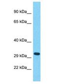 OR56B1 Antibody - OR56B1 antibody Western Blot of ACHN. Antibody dilution: 1 ug/ml.  This image was taken for the unconjugated form of this product. Other forms have not been tested.