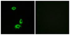 OR56B1 Antibody - Immunofluorescence analysis of HUVEC cells, using OR56B1 Antibody. The picture on the right is blocked with the synthesized peptide.