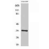 OR56B4 Antibody - Western blot of Olfactory receptor 56B4 antibody