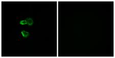 OR56B4 Antibody - Immunofluorescence analysis of MCF7 cells, using OR56B4 Antibody. The picture on the right is blocked with the synthesized peptide.