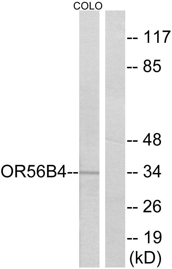 OR56B4 Antibody - Western blot analysis of lysates from COLO cells, using OR56B4 Antibody. The lane on the right is blocked with the synthesized peptide.