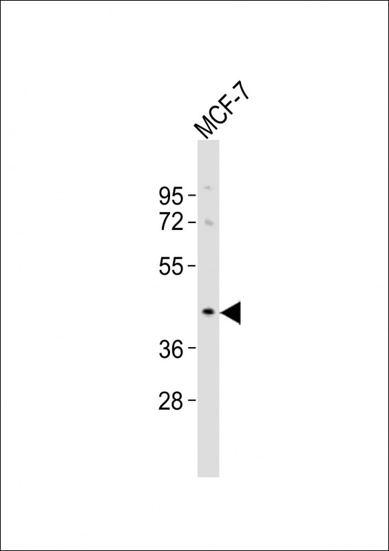 OR5A1 Antibody - Anti-OR5A1 Antibody at 1:1000 dilution + MCF-7 whole cell lysates Lysates/proteins at 20 ug per lane. Secondary Goat Anti-Rabbit IgG, (H+L), Peroxidase conjugated at 1/10000 dilution Predicted band size : 35 kDa Blocking/Dilution buffer: 5% NFDM/TBST.