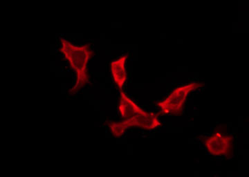 OR5A1 Antibody - Staining MCF-7 cells by IF/ICC. The samples were fixed with PFA and permeabilized in 0.1% Triton X-100, then blocked in 10% serum for 45 min at 25°C. The primary antibody was diluted at 1:200 and incubated with the sample for 1 hour at 37°C. An Alexa Fluor 594 conjugated goat anti-rabbit IgG (H+L) Ab, diluted at 1/600, was used as the secondary antibody.