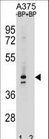 OR5AC2 / HSA1 Antibody - OR5AC2 Antibody pre-incubated without(lane 1) and with(lane 2) blocking peptide in A375 cell line lysate. OR5AC2 Antibody (arrow) was detected using the purified antibody.